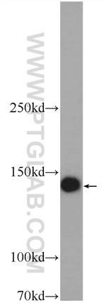 TTC37 Antibody in Western Blot (WB)