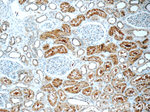 TTC37 Antibody in Immunohistochemistry (Paraffin) (IHC (P))