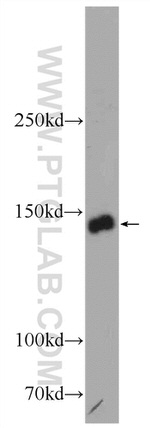 TTC37 Antibody in Western Blot (WB)