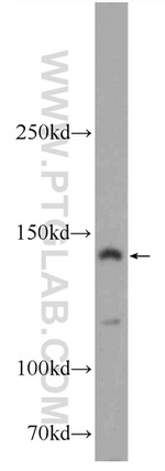 TTC37 Antibody in Western Blot (WB)