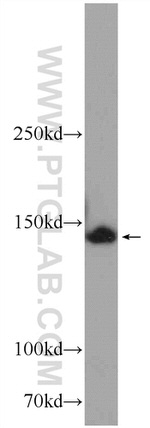 TTC37 Antibody in Western Blot (WB)