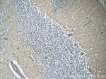 RAB3GAP2 Antibody in Immunohistochemistry (Paraffin) (IHC (P))