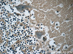 RAB3GAP2 Antibody in Immunohistochemistry (Paraffin) (IHC (P))