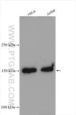 RAB3GAP2 Antibody in Western Blot (WB)