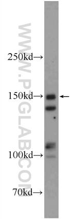 RAB3GAP2 Antibody in Western Blot (WB)