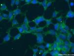 Tuberin Antibody in Immunocytochemistry (ICC/IF)