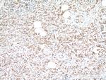 Tuberin Antibody in Immunohistochemistry (Paraffin) (IHC (P))