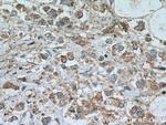 Tuberin Antibody in Immunohistochemistry (Paraffin) (IHC (P))