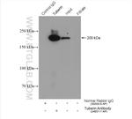 Tuberin Antibody in Immunoprecipitation (IP)