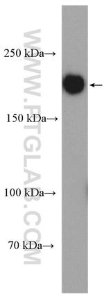 Tuberin Antibody in Western Blot (WB)