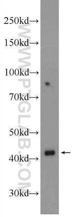 UPB1 Antibody in Western Blot (WB)