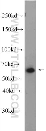 GRK1 Antibody in Western Blot (WB)