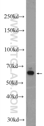 GRK1 Antibody in Western Blot (WB)