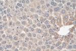 SLC22A1 Antibody in Immunohistochemistry (Paraffin) (IHC (P))