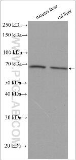 SLC22A1 Antibody in Western Blot (WB)