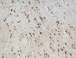 NPBWR1 Antibody in Immunohistochemistry (Paraffin) (IHC (P))