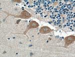 NPBWR1 Antibody in Immunohistochemistry (Paraffin) (IHC (P))