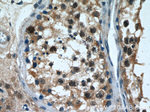 TOP2A Antibody in Immunohistochemistry (Paraffin) (IHC (P))