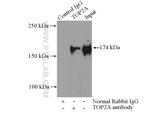 TOP2A Antibody in Immunoprecipitation (IP)