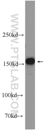 TOP2A Antibody in Western Blot (WB)