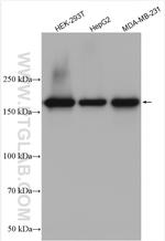 TOP2A Antibody in Western Blot (WB)