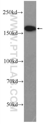 TOP2A Antibody in Western Blot (WB)