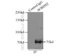 SORBS2 Antibody in Immunoprecipitation (IP)