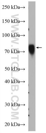 SORBS2 Antibody in Western Blot (WB)