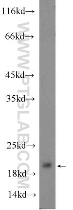 GKN2 Antibody in Western Blot (WB)