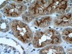 SGLT2 Antibody in Immunohistochemistry (Paraffin) (IHC (P))