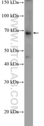 SGLT2 Antibody in Western Blot (WB)