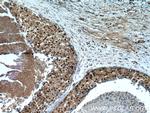 SRA1 Antibody in Immunohistochemistry (Paraffin) (IHC (P))