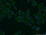 EHD1 Antibody in Immunocytochemistry (ICC/IF)