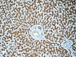 PHKA2 Antibody in Immunohistochemistry (Paraffin) (IHC (P))