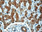 PHKA2 Antibody in Immunohistochemistry (Paraffin) (IHC (P))