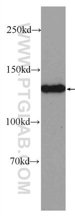 PHKA2 Antibody in Western Blot (WB)