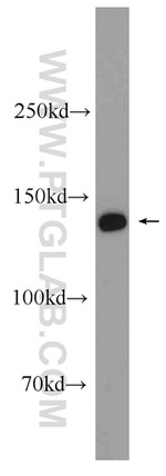 PHKA2 Antibody in Western Blot (WB)