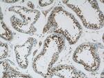 LRPAP1 Antibody in Immunohistochemistry (Paraffin) (IHC (P))