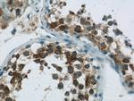 LRPAP1 Antibody in Immunohistochemistry (Paraffin) (IHC (P))