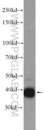 LRPAP1 Antibody in Western Blot (WB)