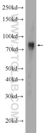 GGT7 Antibody in Western Blot (WB)