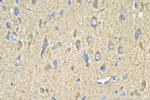 SYNJ1 Antibody in Immunohistochemistry (Paraffin) (IHC (P))