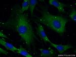 SYNJ1 Antibody in Immunocytochemistry (ICC/IF)