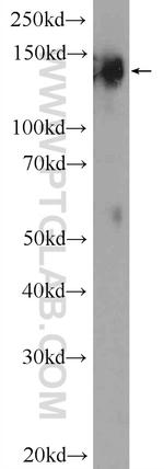 SYNJ1 Antibody in Western Blot (WB)