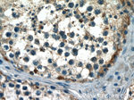 CCDC99 Antibody in Immunohistochemistry (Paraffin) (IHC (P))