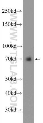 CCDC99 Antibody in Western Blot (WB)