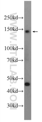 HELB Antibody in Western Blot (WB)