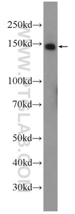 HELB Antibody in Western Blot (WB)