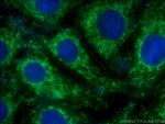 PVRL1 Antibody in Immunocytochemistry (ICC/IF)