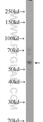 ZFP2 Antibody in Western Blot (WB)